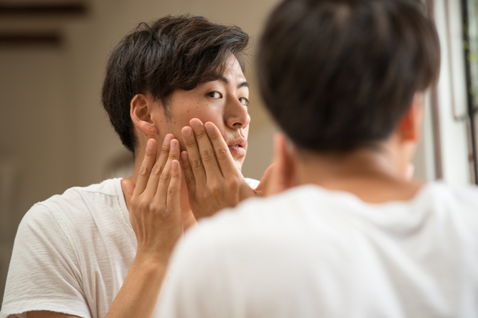 大人ニキビにきび跡の治療　男性専門美容外科ピュアメンズクリニック奈良